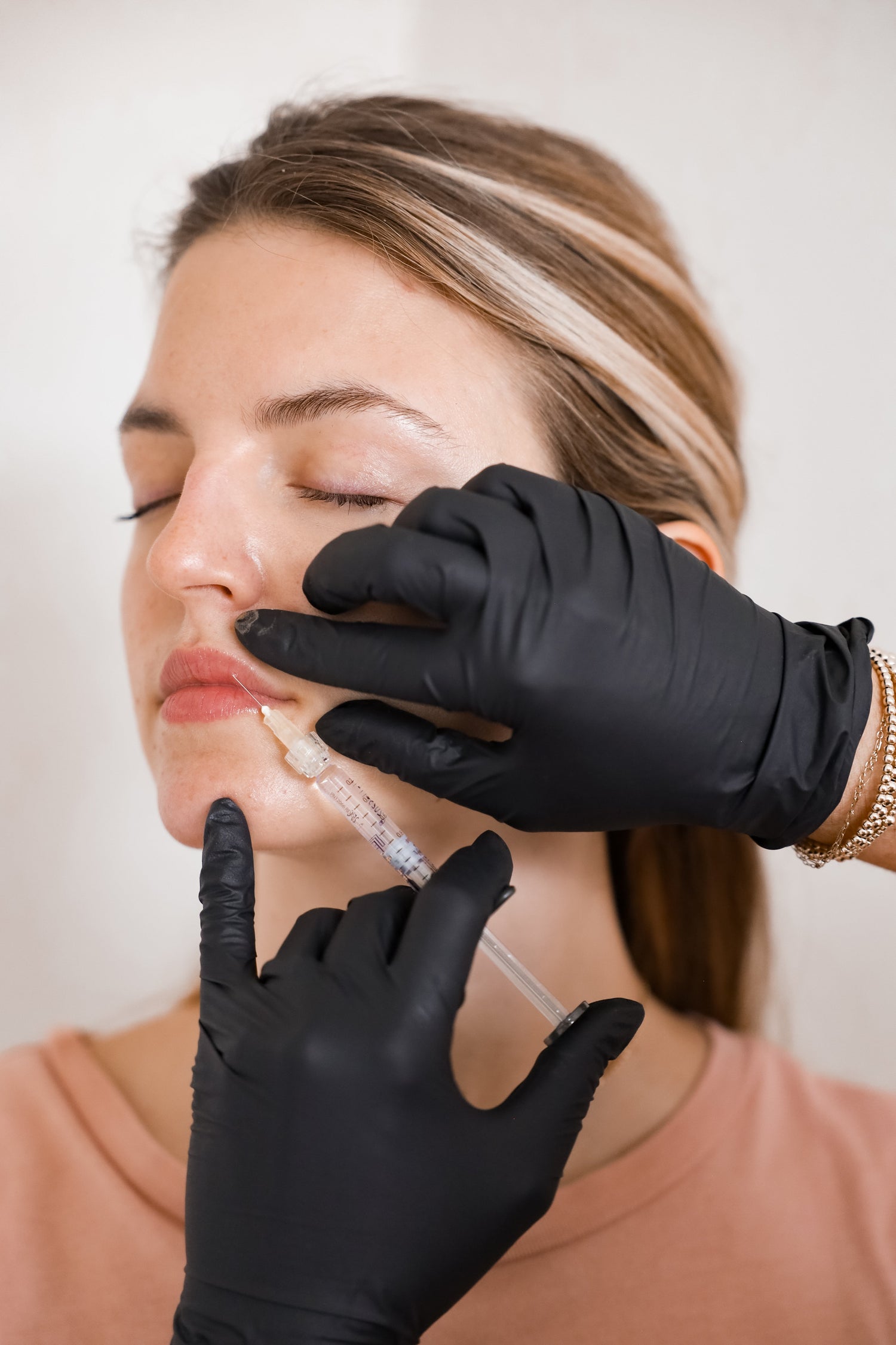 Lip Flip or Lip Filler?