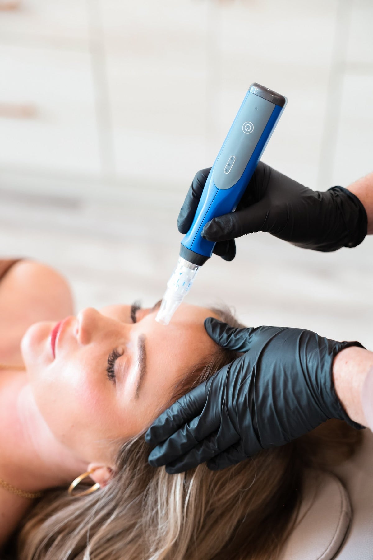 Microneedling vs. Chemical Peels: Which Is Best for Your Skin?