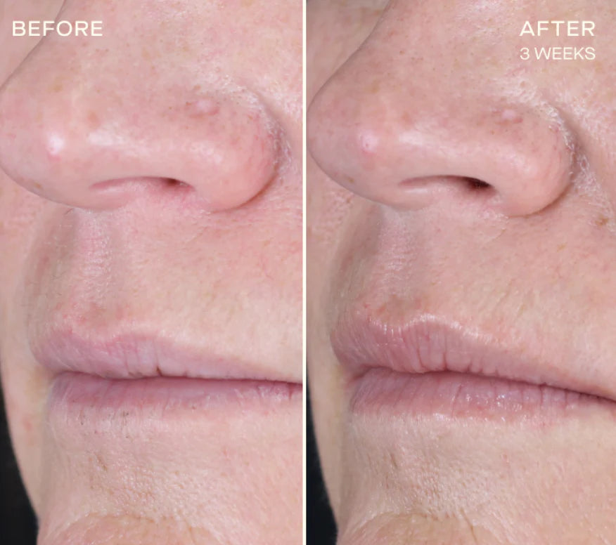 Ourself The Lip Plumping and Enhancing Regimen