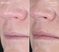Ourself The Lip Plumping and Enhancing Regimen