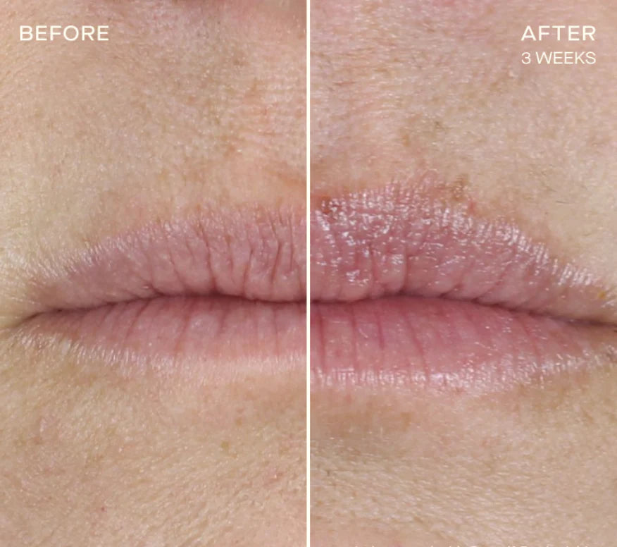 Ourself The Lip Plumping and Enhancing Regimen