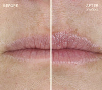 Ourself The Lip Plumping and Enhancing Regimen