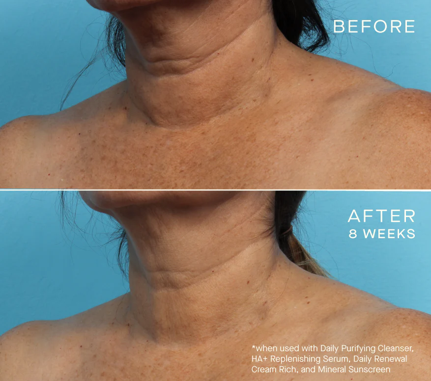 Ourself Advanced Regenerating Serum