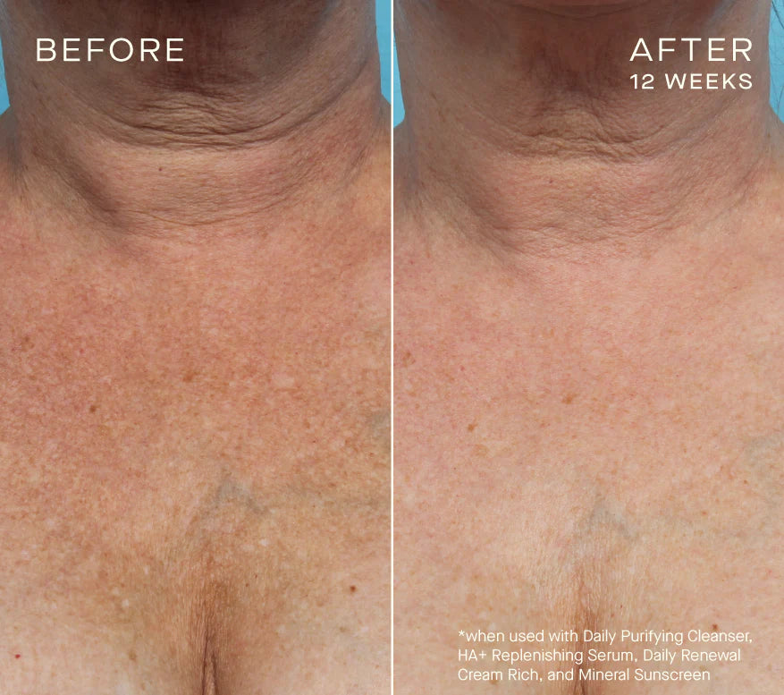 Ourself Advanced Regenerating Serum