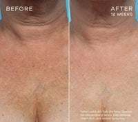 Ourself Advanced Regenerating Serum