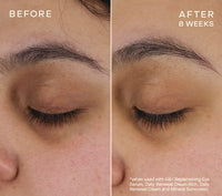 Ourself Advanced Regenerative Eye Serum